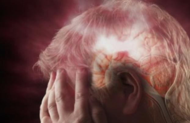 Кои се симптомите на мозочен удар?