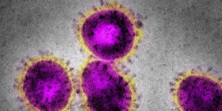 Австралија бара истрага за потеклото на коронавирусот, 116 земји се „за“