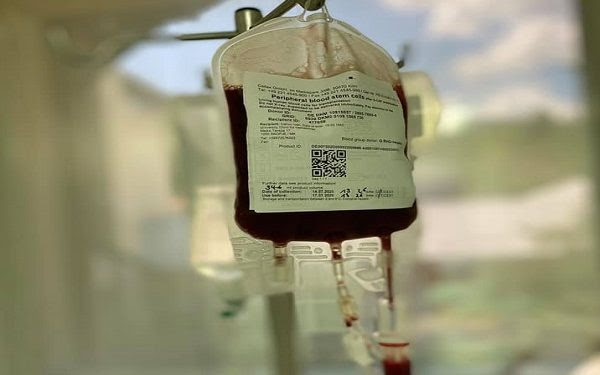 СЗО: Крвната плазма не треба да се користи за лекување на пациенти со Ковид-19