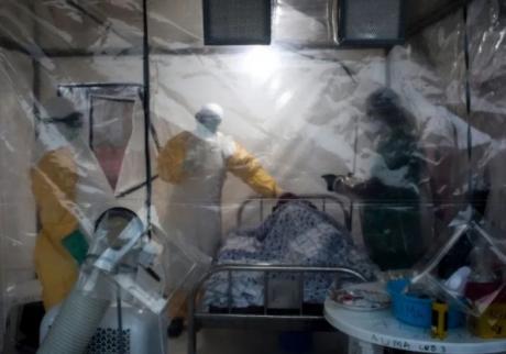 Мистериозна болест „коси“ во Танзанија: Докторот кој предупредил на последиците веднаш суспендиран