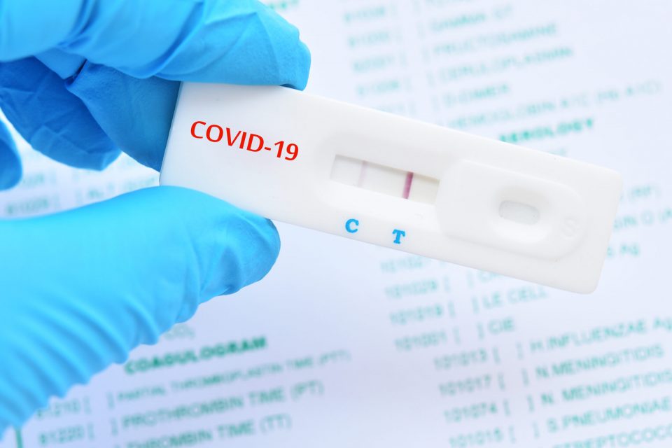 50-годишна скопјанка третпат добила позитивен тест на коронавирус