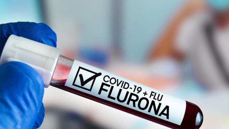 Во Македонија потврдени седум пациенти инфицирани со флурона