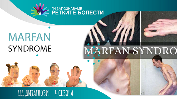 Ги запознаваме ретките болести: Марфанов синдром