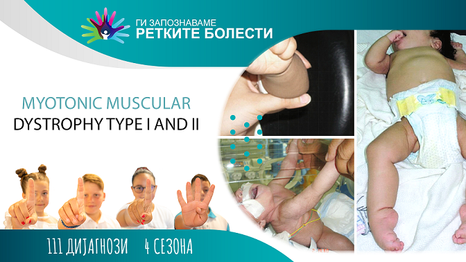 Ги запознаваме ретките болести: Миотонична мускулна дистрофија тип I и II