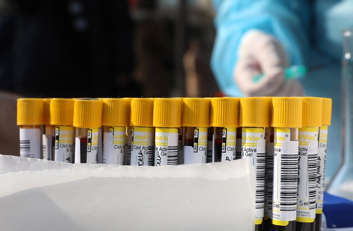 Тројца пациенти починаа од ковид, уште 195 заразени од 2.249 тестови