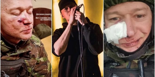 Андриј Хливнјук, фронтменот на украинскиот бенд Boombox повреден во минофрлачки напад во Украина