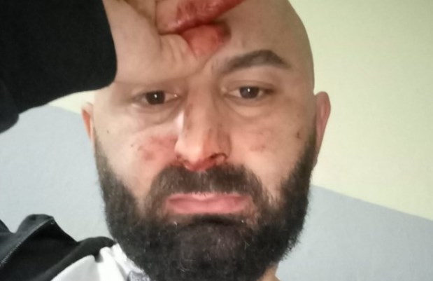 ЛГБТ активистот Беким Асани е претепан  на гробишта во Тетово, пред очите на мајка му