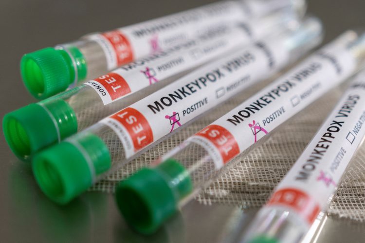 Во Грција пристигнаа 2.300 дози од вакцината против мајмунски сипаници