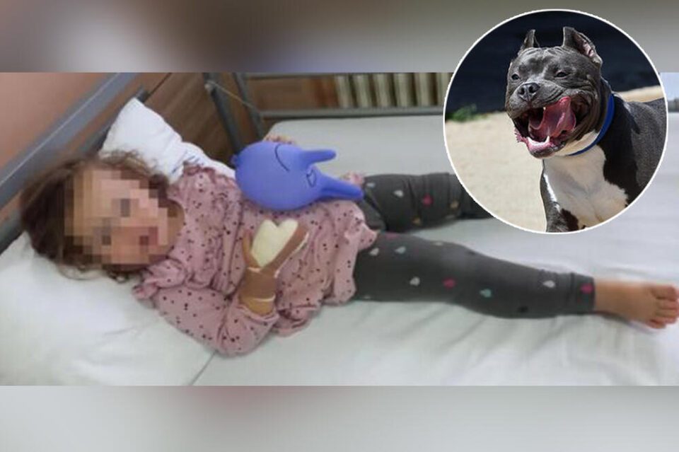 Двегодишно девојче остана без прст откако куче скитник ѝ го одргриза и изеде
