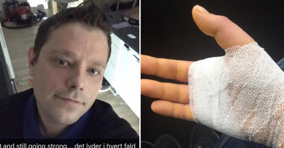 По четири години агонија и болки, почина мажот кому мачка му го гризна прстот
