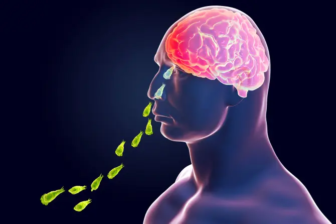 Човек на Флорида заразен со амеба што го јаде мозокот – се започнува со главоболка