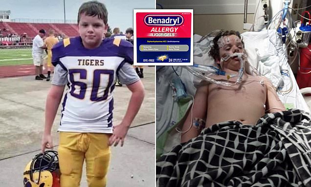 Почина 13-годишно дете кое испи 14 апчиња „бенадрил“ како Тик ток предизвик
