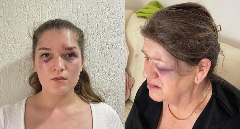 Мелиса од Петровец и мајка и се претепани од соседот: Уште колкумина треба да бидат физички нападнати од тој монструм, за оваа држава да реагира?