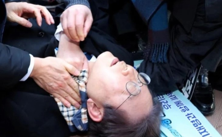 Лидерот на јужнокорејската опозиција е опериран и свесен по нападот со нож во вратот