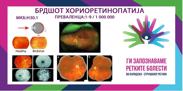 Ги запознаваме ретките болести во охридско – струшкиот регион: Бирдшот хориоретинопатија