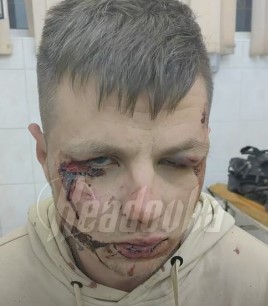 Вознемирувачко: Неколкумина украински бегалци тепаат припадник на „Вагнер“