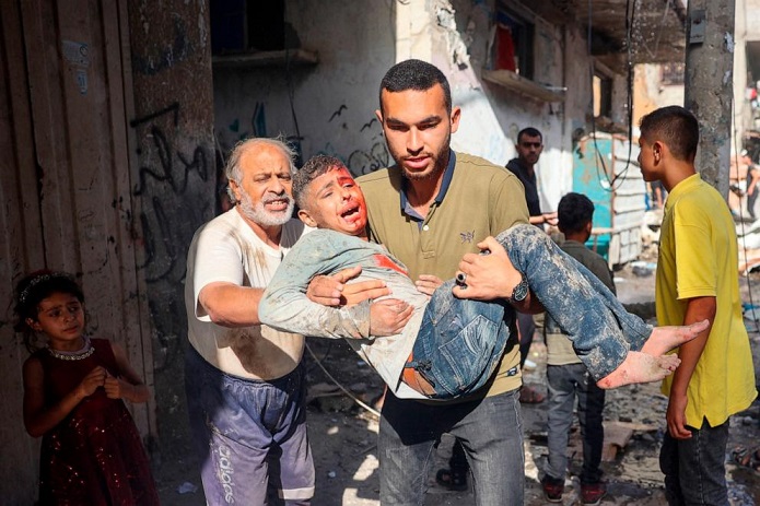 Десет деца дневно губат една или две нозе во Газа